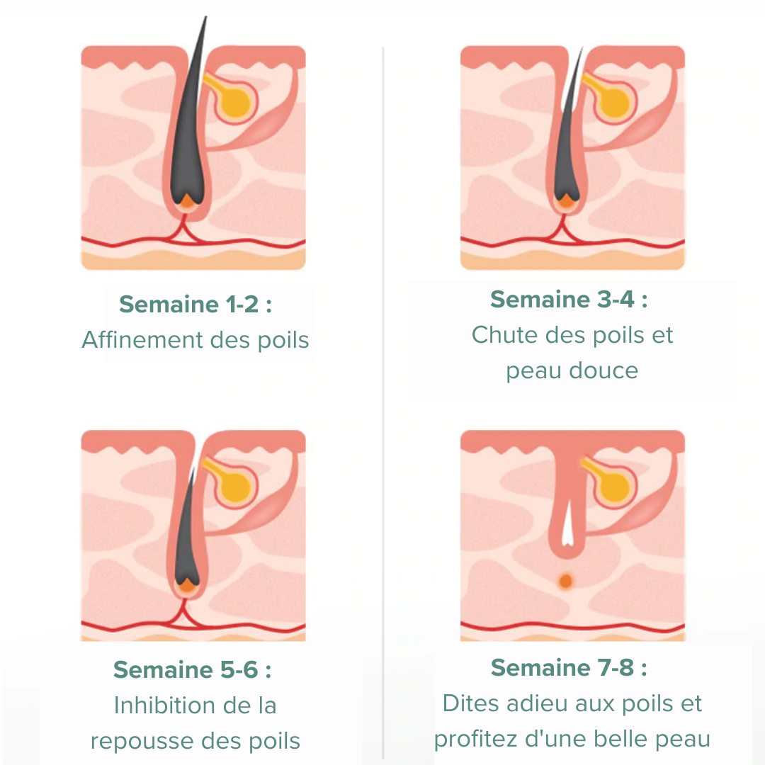 Sérum anti-poils DEPILcare