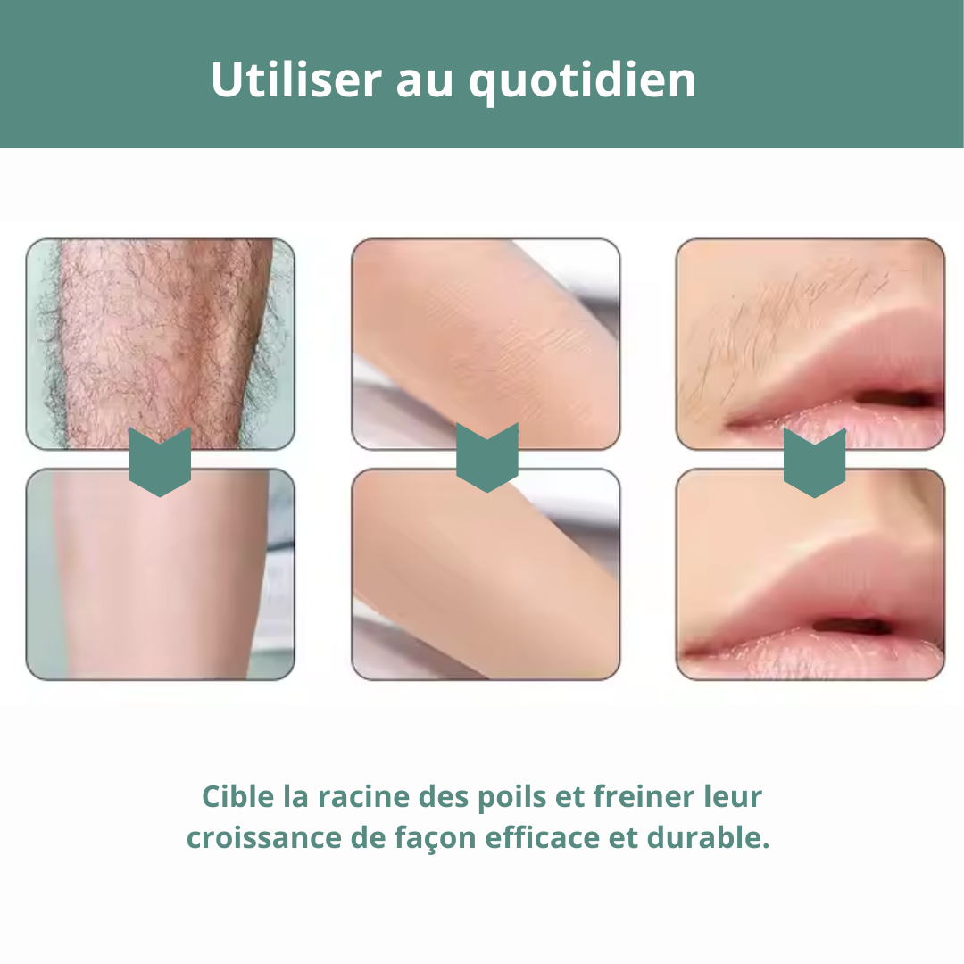 Sérum anti-poils DEPILcare